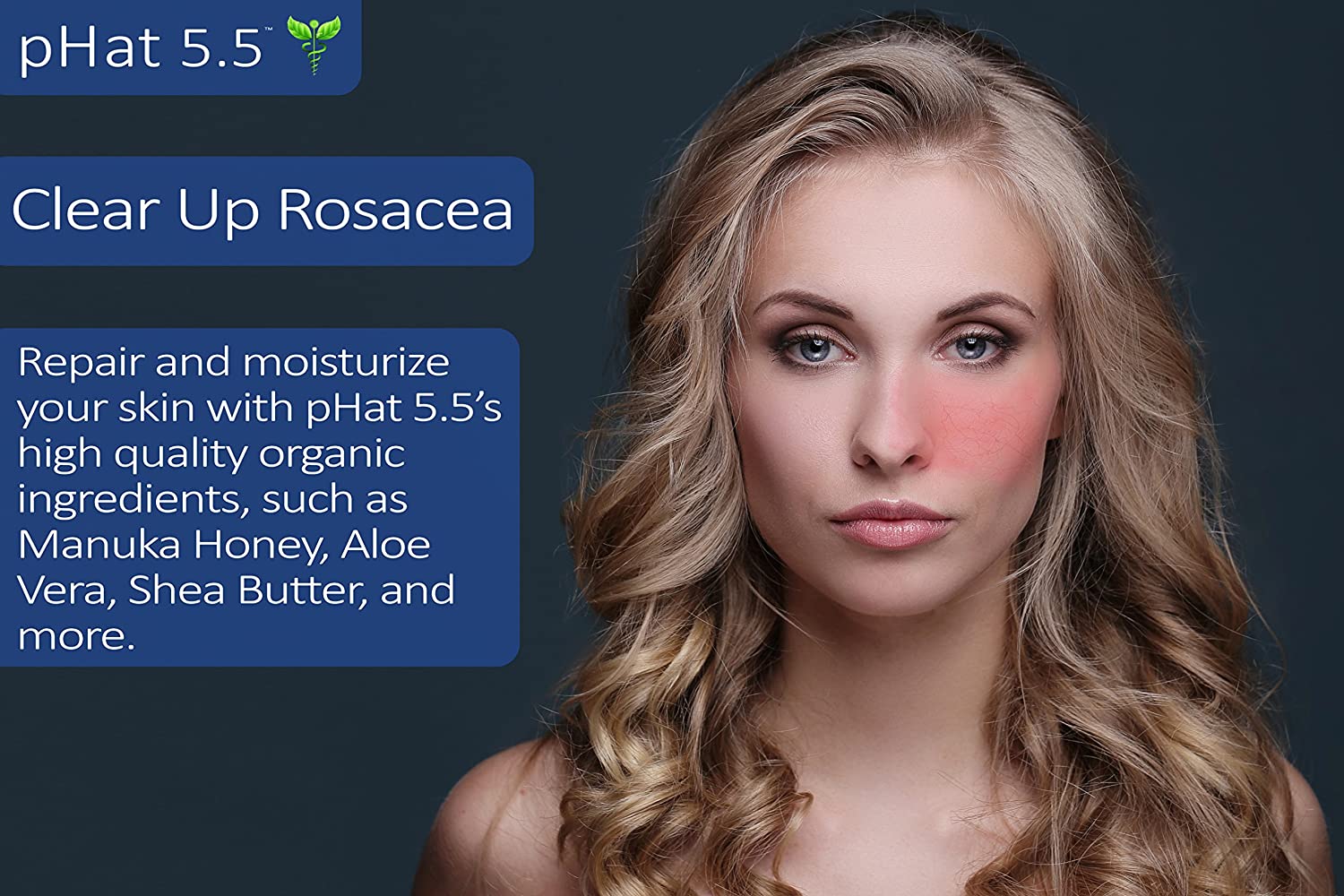 Rosacea Lotion | Manuka Honey Skincare | pHat5.5