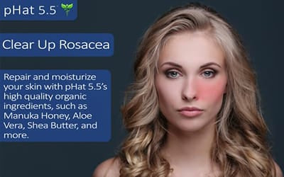 Rosacea Skin Care
