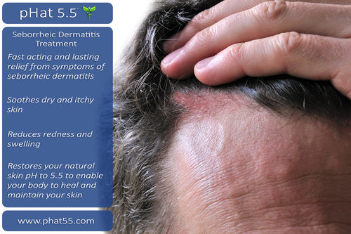 Seborrheic Dermatitis Hair Care