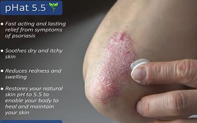 Psoriasis Solutions