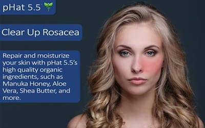 Clear Up Rosacea